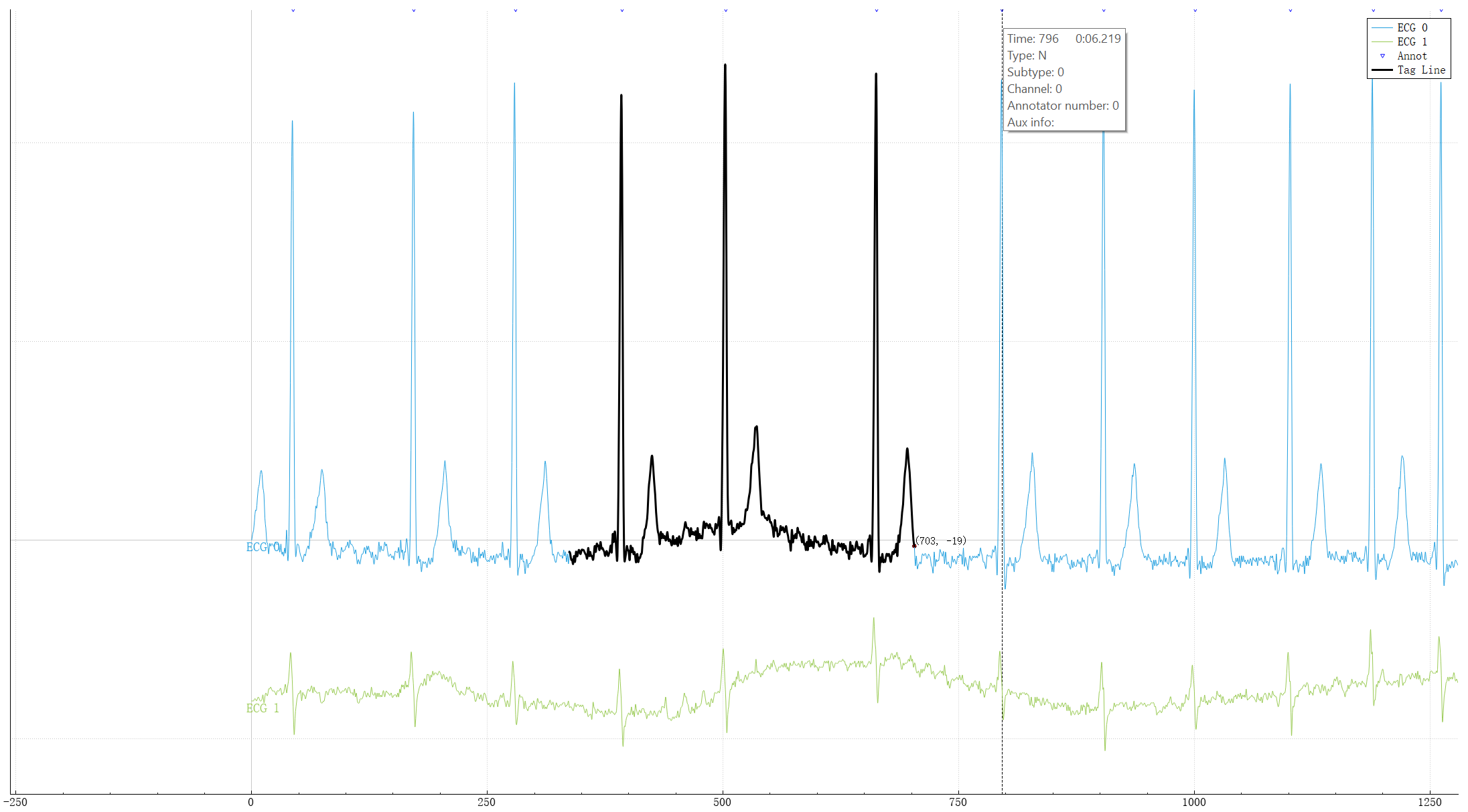 EcgAnalyzer